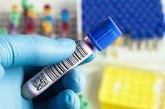 Blood Tube